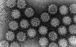 東京都臨床医学総合研究所のデータから ノロウイルスの拡大画像