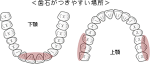 歯石がつきやすい場所