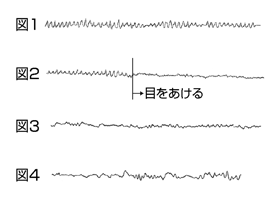 脳波の変化