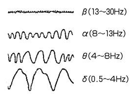 上からベータ、アルファ、スィータ、デルタ波